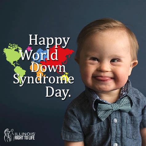 Down syndrome day - March 21 marks World Down Syndrome Day, the holiday being on the 21st day of the third month to signify the triplication of the 21st chromosome, which is the cause of Down syndrome, according to the World Down Syndrome Day website. Whether you know someone with Down syndrome or not, today is a special day with much cause to celebrate.